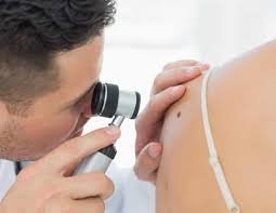 natural actinic keratosis supplements dermatologists don’t talk about
